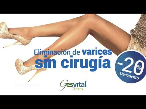 eliminar varices madrid gesvital