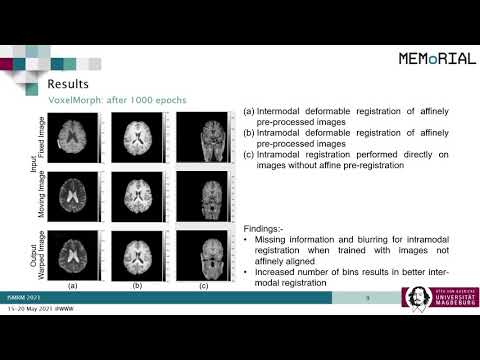 A Comparative Study of Deep Learning Based Deformable Image Registration Techniques