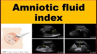 Amniotic fluid index