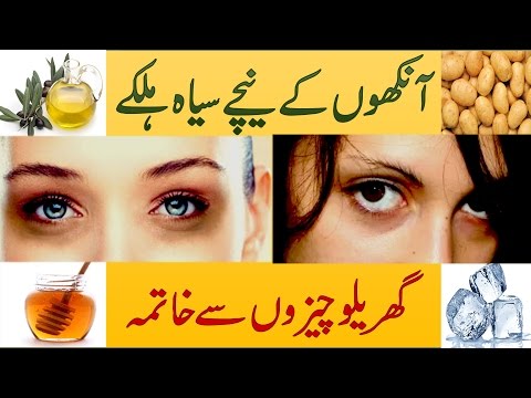Dark Circles Under Eyes Removal & Treatment with Home Remedies in Urdu Hindi Video