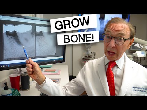 AMAZING Results of BONE GROWTH! With Gum Disease Treatment
