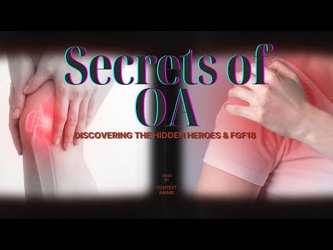 Unveiling OA: Cartilage Saviors & FGF18