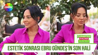 Estetik itirafından sonra ilk paylaşım!
