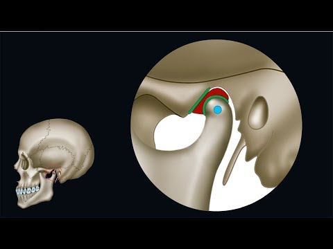Schmerzen in den Gelenken des Halses Salbe für Gelenkentzündung im Bein