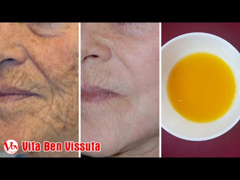 Addio alle rughe e alle lentiggini velocemente con solo 3 ingredienti semplici