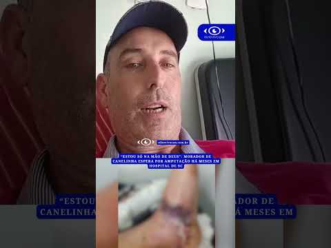 “Estou só na mão de Deus”: Morador de Canelinha espera amputação há meses em hospital de SC