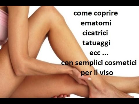 Osteocondrosi della colonna vertebrale lombosacrale. 3 periodo Che fa male in vita a destra e parte bassa della schiena