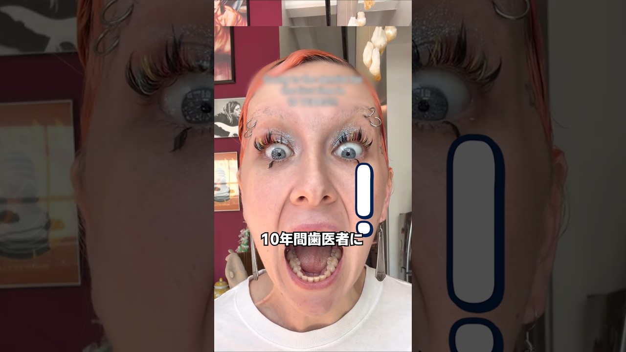 10年ぶりに歯医者に行ったアメリカ人