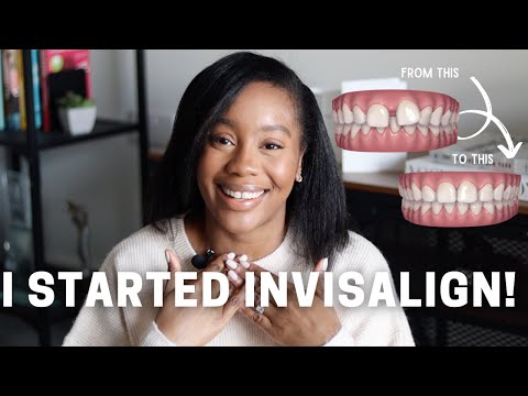 INVISALIGN JOURNEY #1 | Closing My Gap, Choosing A Dentist, Cost, Pain & Things I Didn't Expect