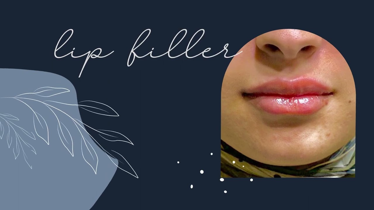 شكل مميز وطبيعي وبدون أي مضاعفات