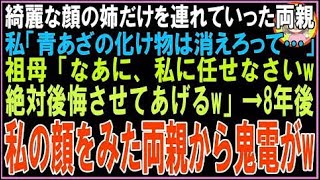 【スカッと】綺麗な顔の姉だけを連れていった両親。私「青あざの化け物は消えろって…」祖母「なあ?