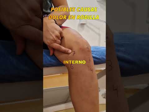 🔷Causes of KNEE pain #physiotherapy #kneepain#