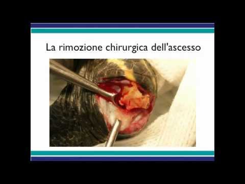 Un aumento del giunto del dito indice Esercizio contro ernia del rachide cervicale