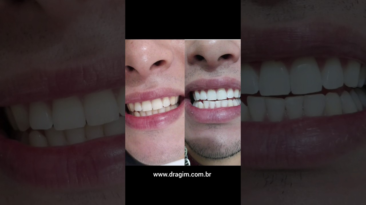 Gislene Isabel De Mendonça-49