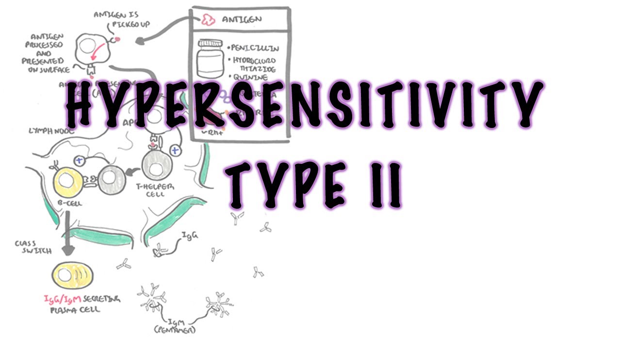 Hypersensitivity Type II (Cytotoxic reaction) - causes, pathophysiology,  complement system