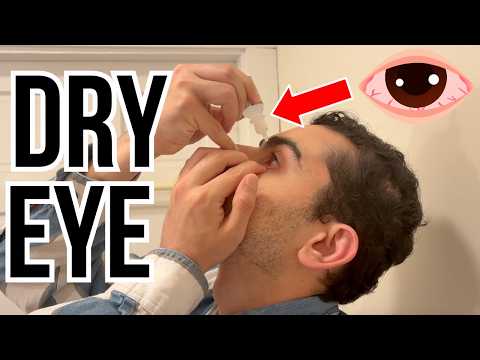 Doctor explains DRY EYE | Causes, treatment and a demonstration of how to correctly apply eye drops