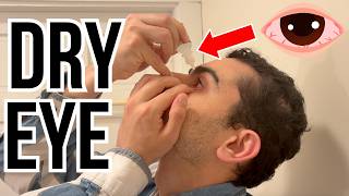 Doctor explains DRY EYE | Causes, treatment and a demonstration of how to correctly apply eye drops