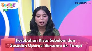 Download lagu Perubahan Rista Sebelum dan Sesudah Operasi Bersama dr.Tompi - BROWNIS (26/11/2025) P2 mp3