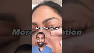 Carboxy Therapy for Dark Under Eye Circles | Dr Somji Explains