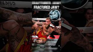 The Trauma Behind the KO | Doctor Explains