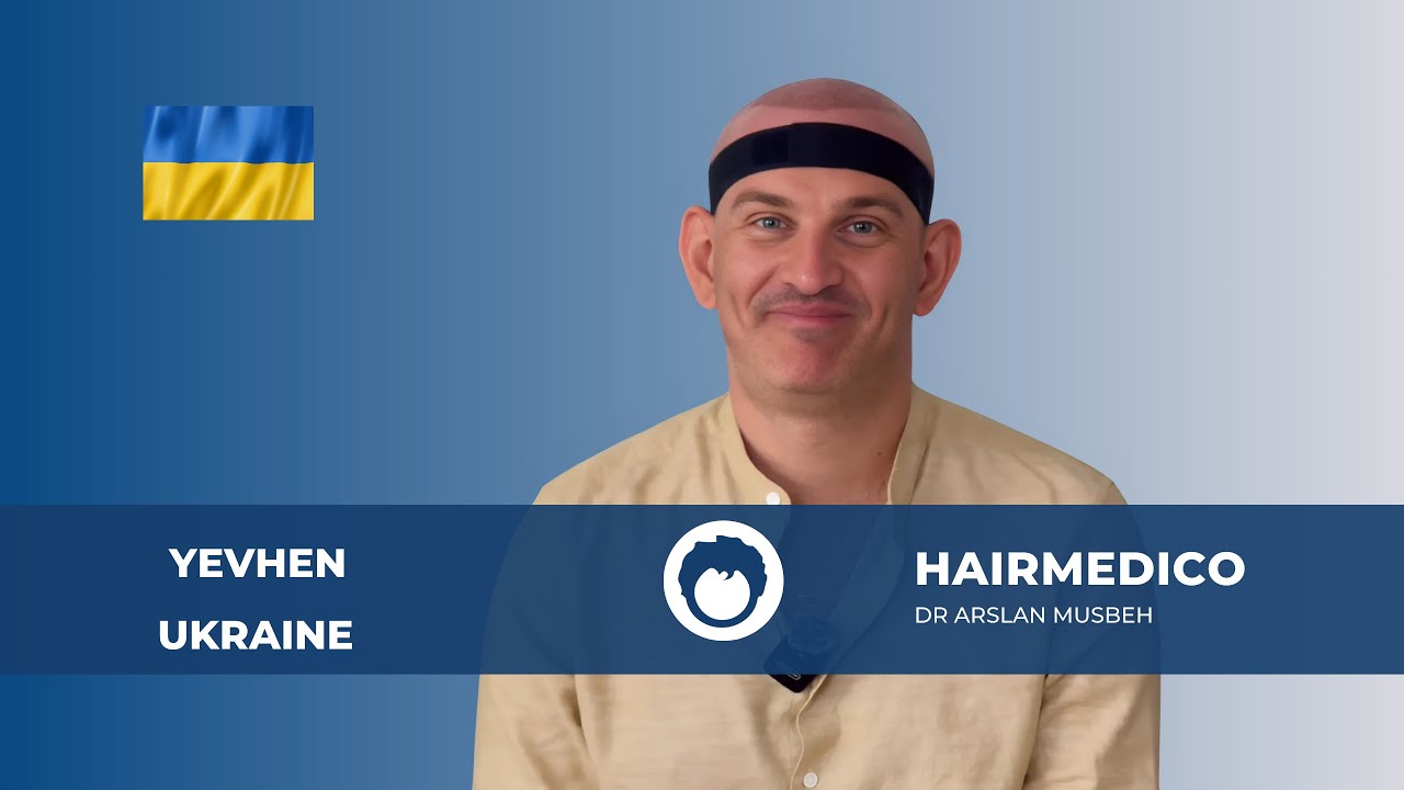 Patient Review — 9 Months After Hair Transplant