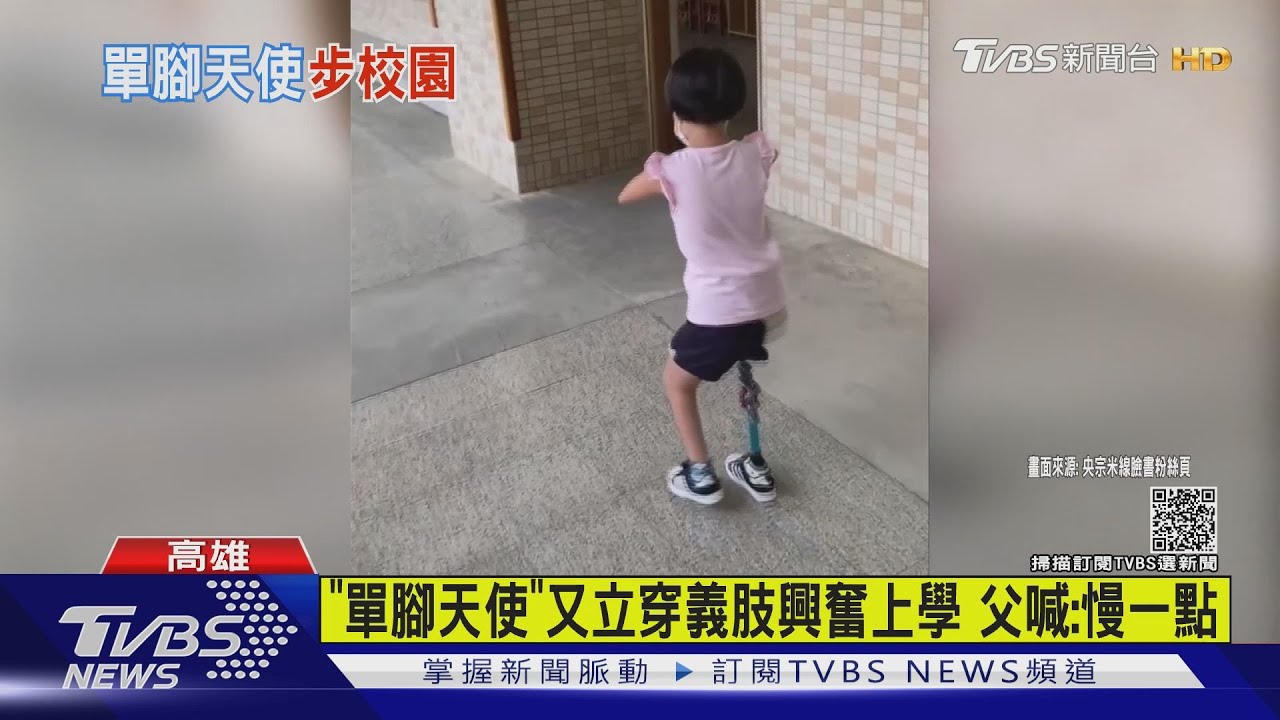 「單腳天使」又立穿義肢興奮上學 父喊:慢一點