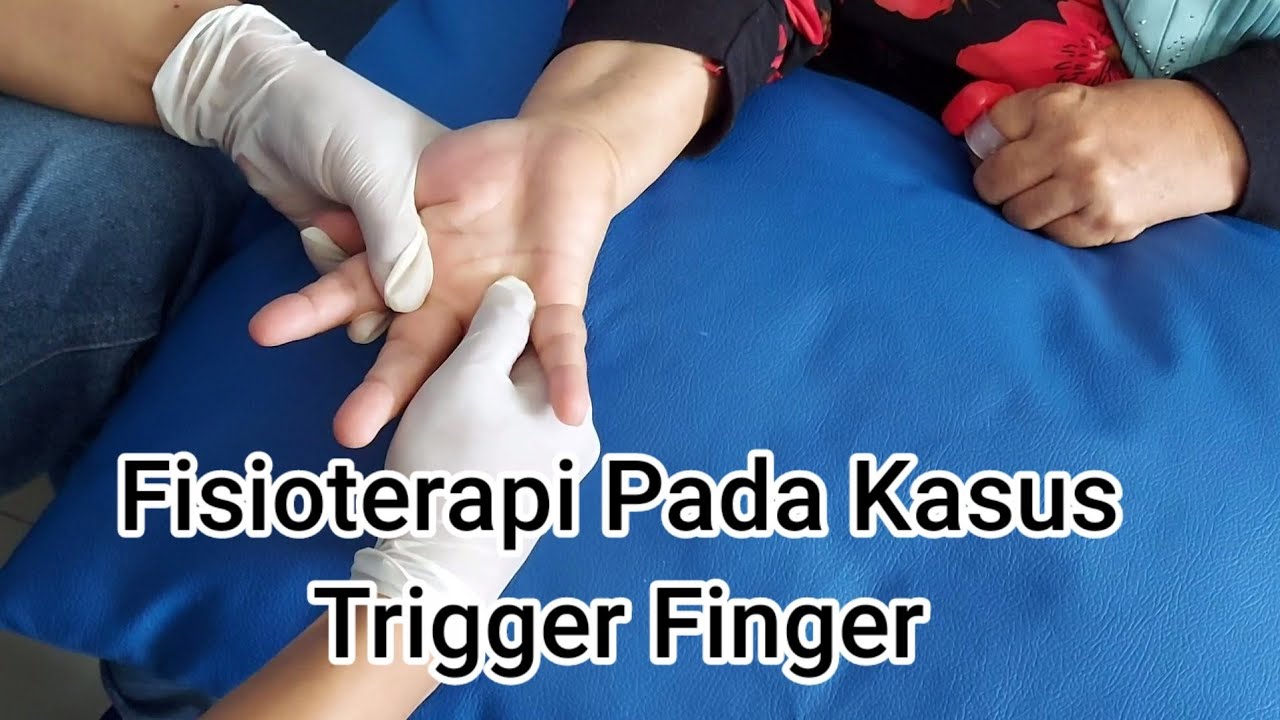 Mengatasi jari macet dengan mudah ||trigger finger
