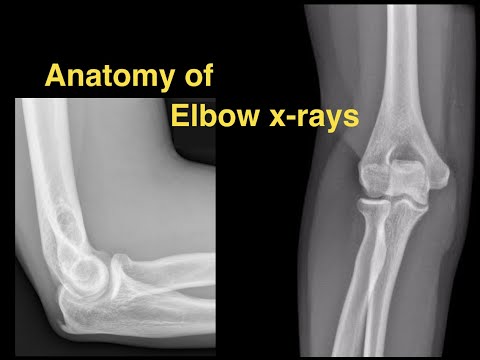 Anatomy of Elbow X-rays