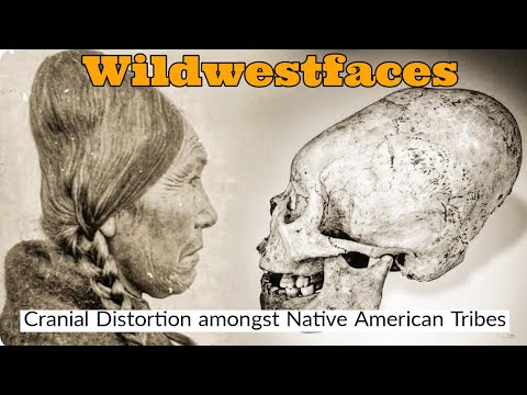 Cranial Distortion amongst Native Americans Tribes