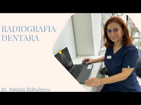 Ți-e Frică de Radiografia Dentară? Vezi Adevărul Despre CBCT și Radiații!