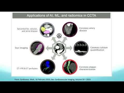 A snapshot of SCCT2023 | 8 talks on CCT that you must hear