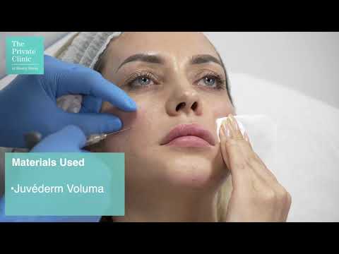 Smile Line Filler, Facial Fillers for Laugh Lines, Contouring Cheek and Chin