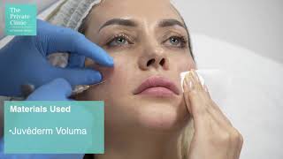 Smile Line Filler, Facial Fillers for Laugh Lines, Contouring Cheek and Chin