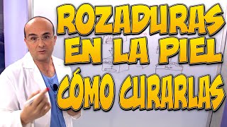 ROZADURAS EN LA PIEL y CÓMO CURARLAS - Enfermedades #42