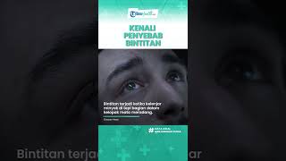 Kenali Penyebab Mata Bintitan yang Kerap Diabaikan, Infeksi Bakteri hingga Penggunaan Lensa Kontak