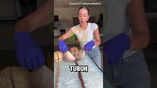 Download lagu STRUKTUR OTAK MANUSIA mp3 Download lagu STRUKTUR OTAK MANUSIA mp3