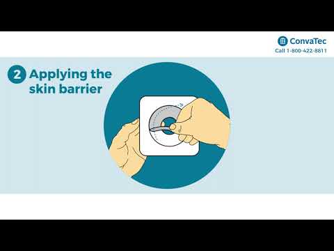 45mm 413161 Convatec Durahesive Base Plate