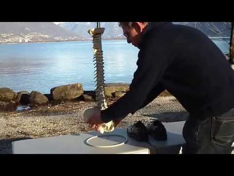 Complicazioni di artrosi dellanca Ginocchio