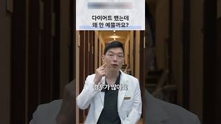 다이어트 후 얼굴이 퀭해 보이는 원인과 관리