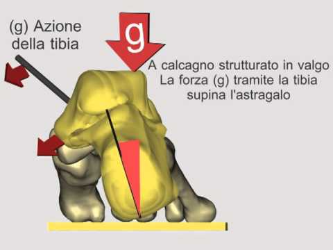 Il trattamento di osteomielite cronica della colonna vertebrale a Monaco di Baviera Mal di schiena sul lato sinistro dà al gluteo