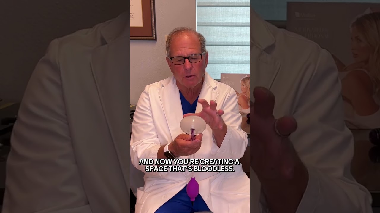 Preservé: The 30-Minute Breast Augmentation Technique