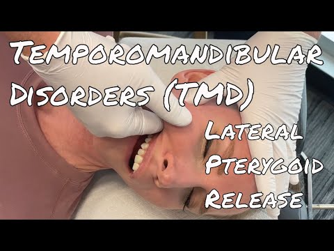 TMD/TMJ Pain - MSR Lateral Pterygoid Release
