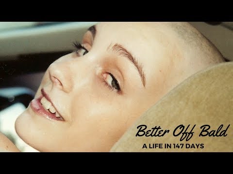 Better Off Bald Episode 38: Day 147