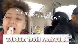 I Got My Wisdom Teeth Removed !!