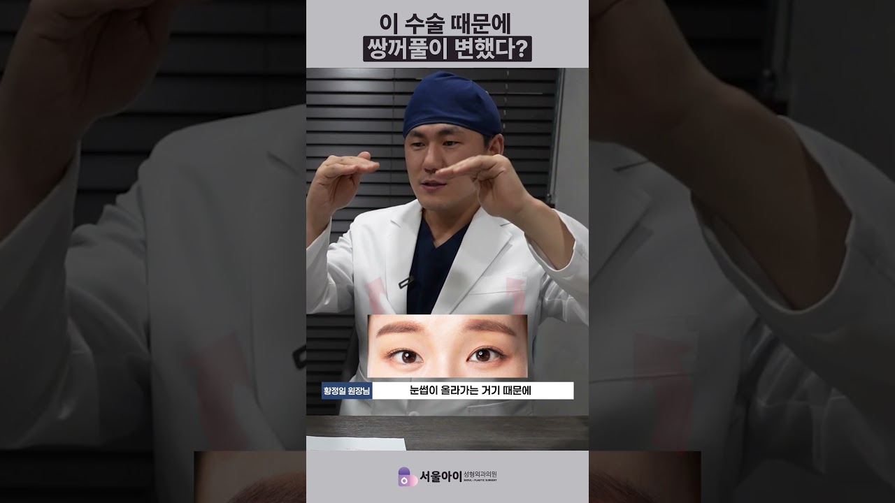 이 수술 때문에 쌍꺼풀이 변했다?