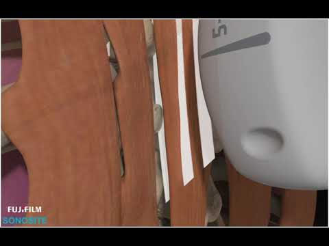 How to: ERECTOR SPINAE BLOCK 3D VIDEO