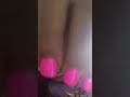 How Long Can Scratch My Legs