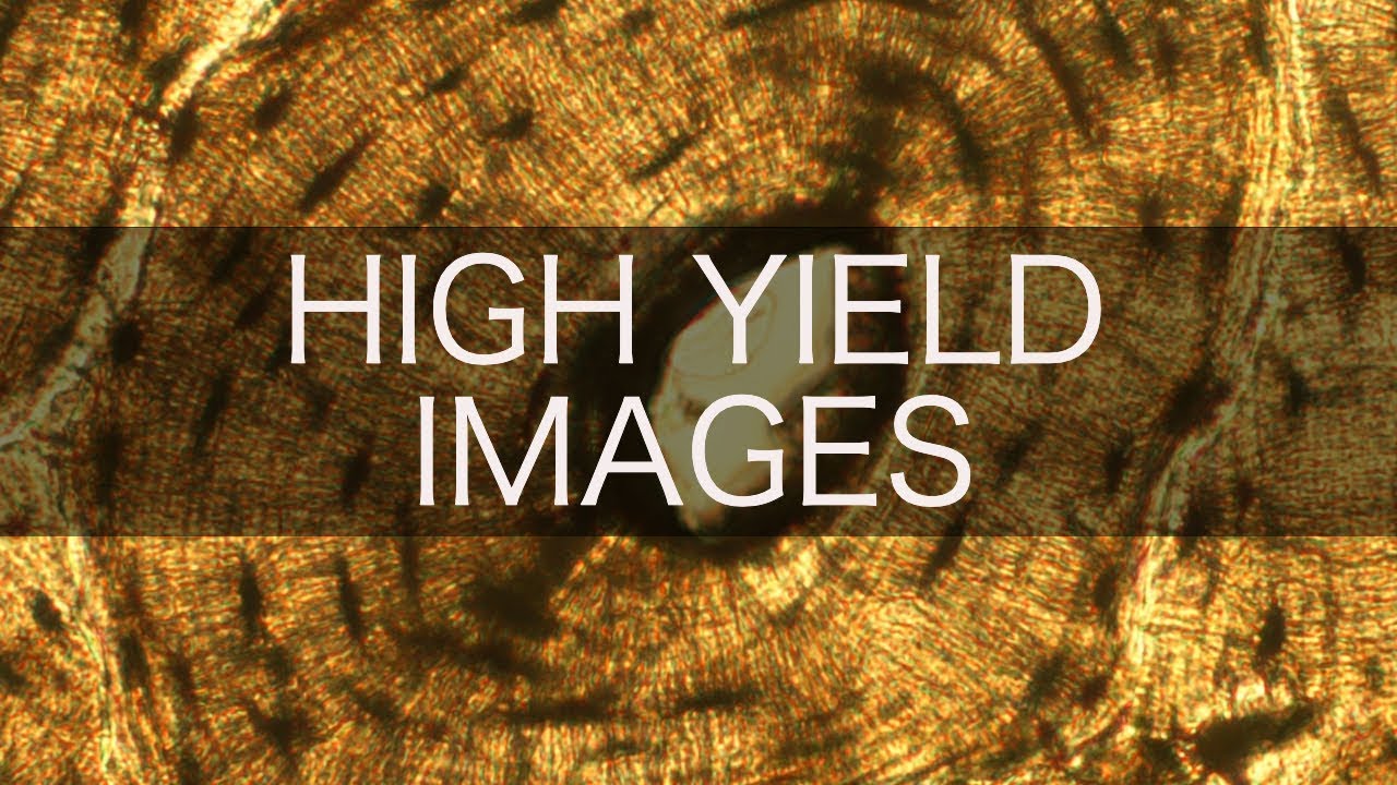 High Yield USMLE/COMLEX Images (pt. 5)