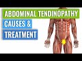Abdominal Tendinopathy - Causes and Treatment, Including Exercises
