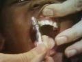 Classic Sesame Street Film A Trip To The Dentist